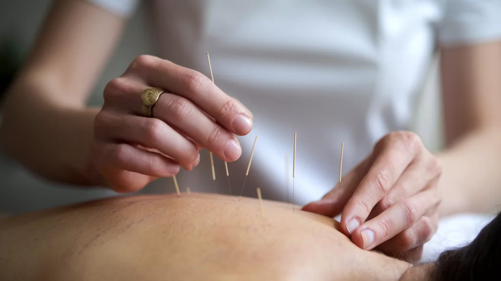 How Much Does Acupuncture Cost